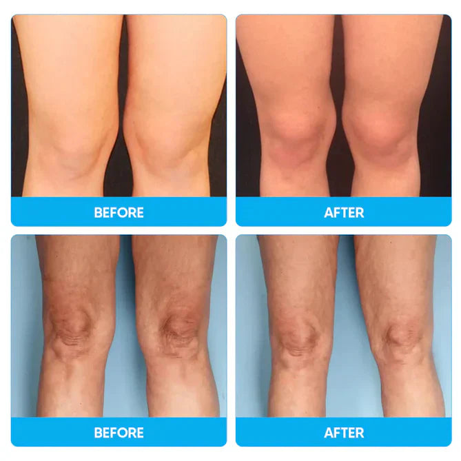 De Premium Kniepijnverlichtende Massager